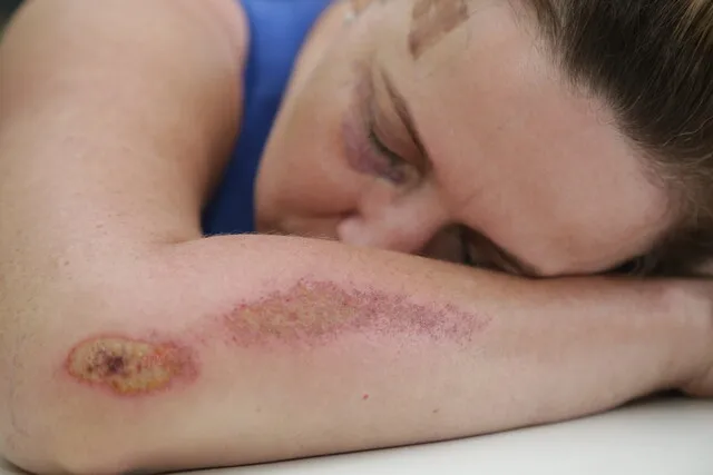 Nos primeiros dez dias do ano, quase 500 mulheres sofreram violência doméstica 