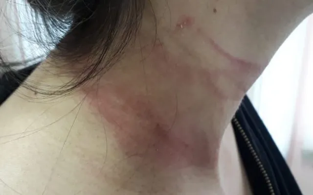 Mulher é arrastada pelos cabelos e jogada no asfalto pelo marido em Rio Brilhante 